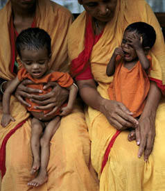 Two children suffering from malnutrition in Dhaka , Bangladesh .