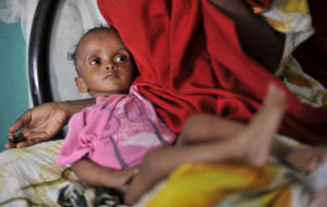 This young Somali was suffering from severe malnutrition after fleeing home with his parents. "More than 50 per cent of Somali children arriving in Ethiopia are seriously malnourished, while among those arriving to Kenya that rate is somewhat lower, but equally worrying � between 30 to 40 per cent,". a  UNHCR spokesperson said.  Photo:Gangale/UNHCR