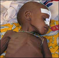 Photo: BBC This is the second worst food crisis in Niger's history