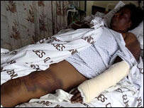 MDC official Sekai Holland is one of those allegedly beaten by police Photo: &nbsp;�BBC