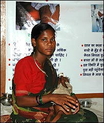 A malnourished child at a health center in India.  Photo:BBC