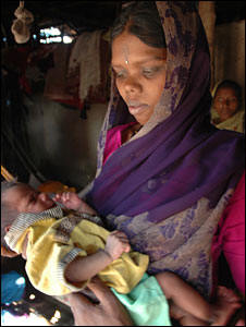 Baby Drupta weighs only 5.5 lbs and coughs incessantly.  Photo: BBC