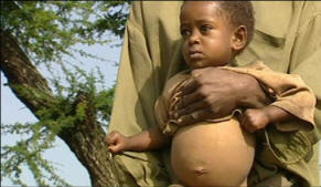 Although there will be a crop this year, there is little food due to past drought.  In every Ethiopian village visited there were vulnerable children, many with distended stomachs, one sign of extreme hunger. Photo: BBC