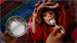 alnutrition in India is worse than in many African nations, stunting the growth of children like this girl in Shivpuri, photographed in November 2008. Photo: Ruth Fremson/The New York Times