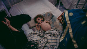 Picture of severely malnourished Afgan child lying on a bed. Photo: Mujahid Safodien/IRIN &nbsp;