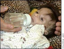 Children in Iraq have suffered substantially increased levels of malnutrition since the Gulf War. A new war would disrupt food supplies and health services, and make them much more vulnerable.