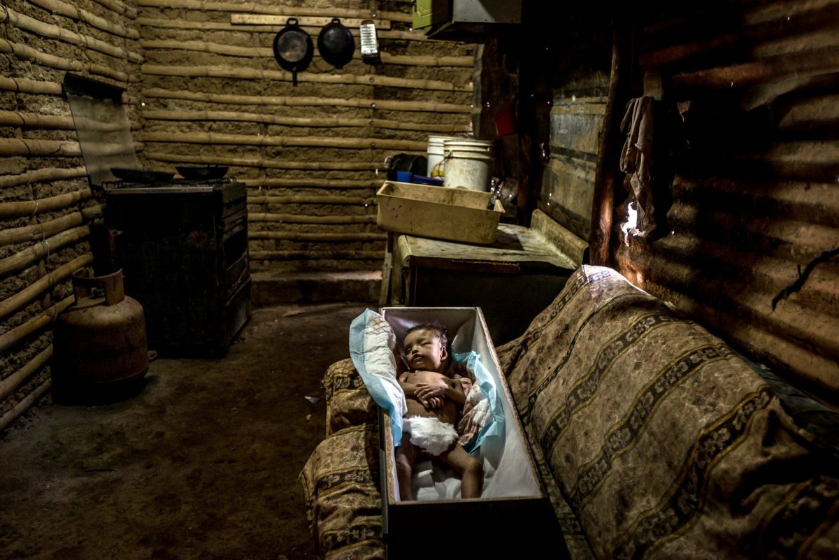 As Venezuela Collapses, Children Are Dying of Hunger